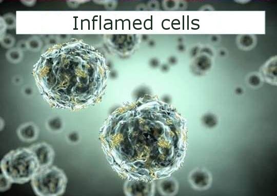 inflamed-cells